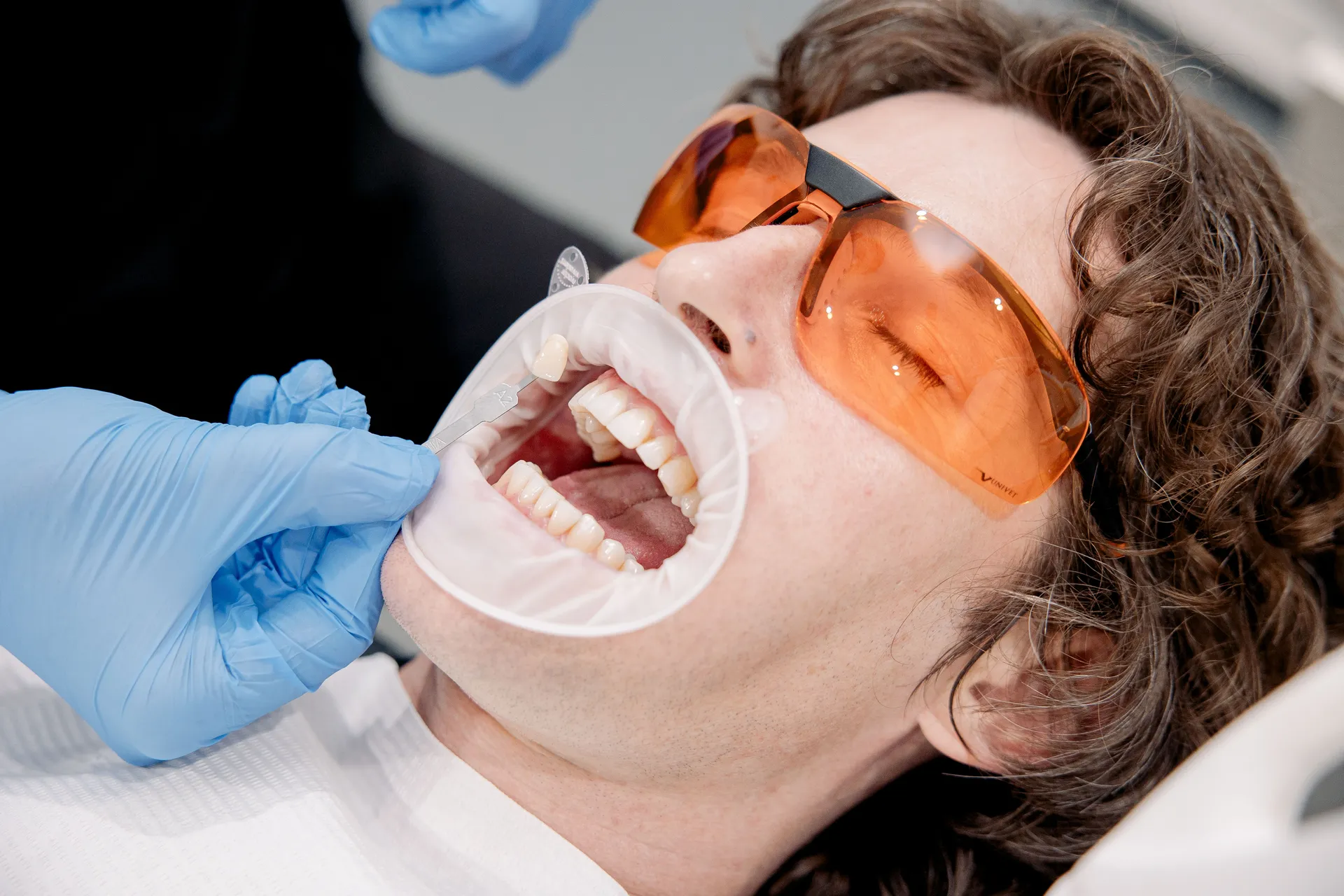 Dental Veneers Sydney