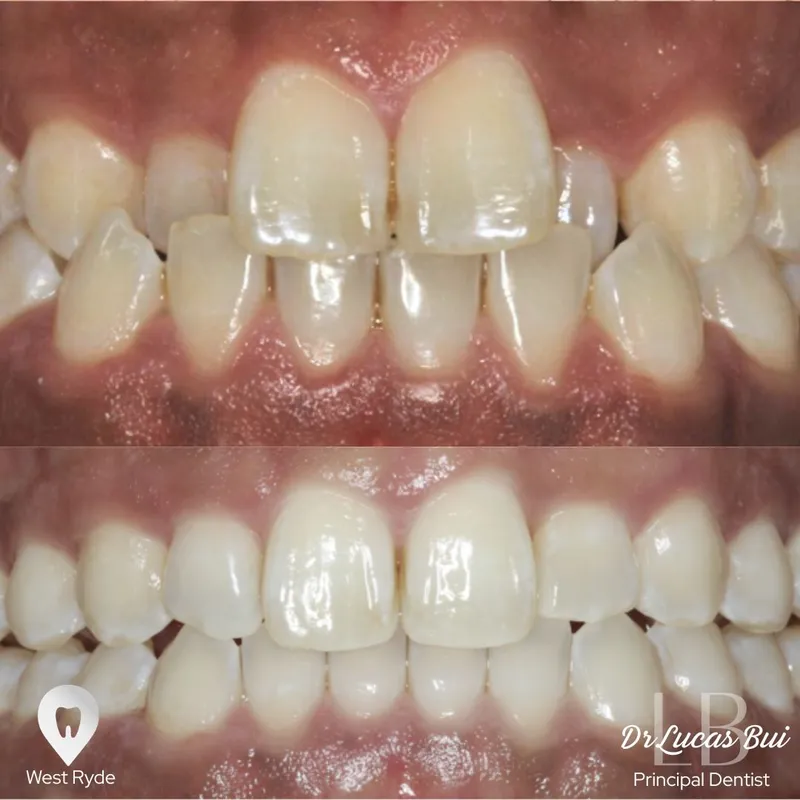 Clear Aligners transformation complete!
