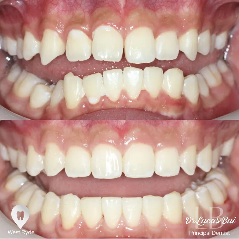 Clear Aligners transformation complete!