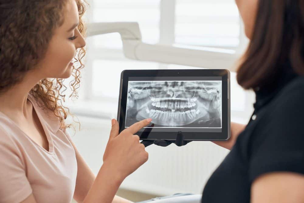 Ask the Dentist: Why are Dental X-Rays important when visiting the dentist?